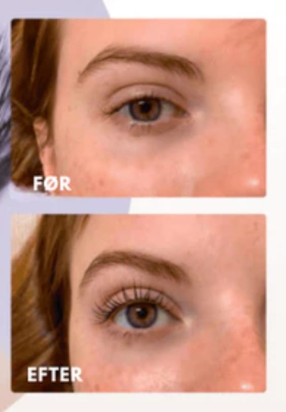 Customer photo review of Vippebukker med varme