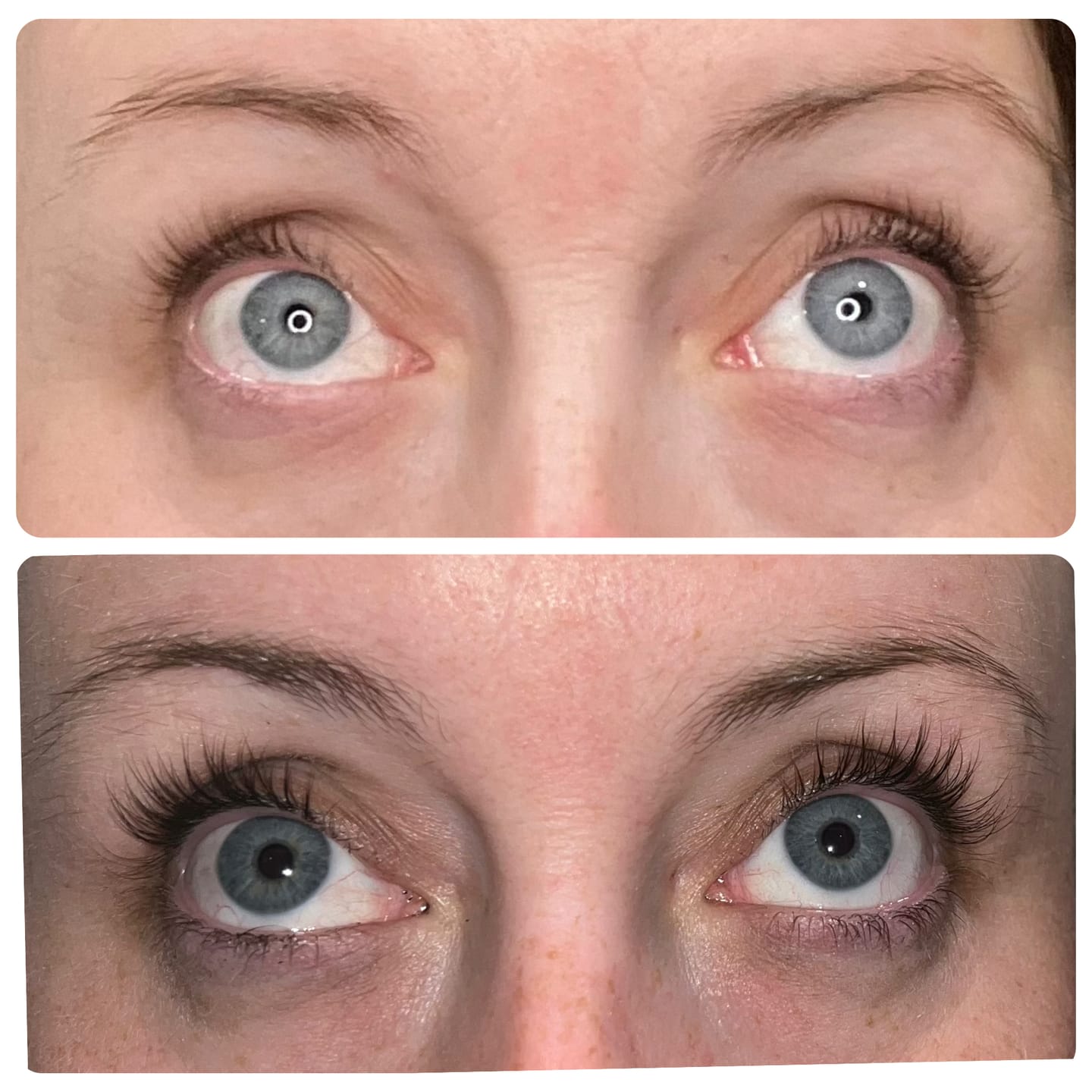 Customer photo review of EYELASH GROWTH SOLUTION