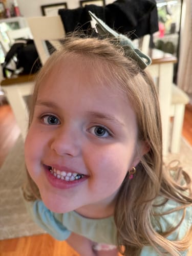 Customer photo review of Gold Huggies