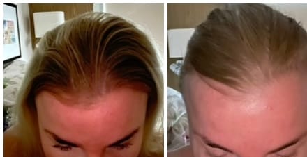 Customer photo review of Sunkissed Starter Kit