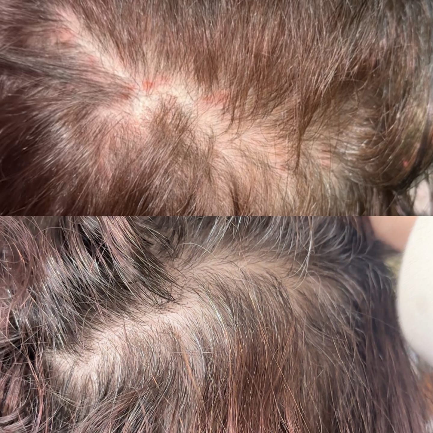 Customer photo review of Hair Growth Oil
