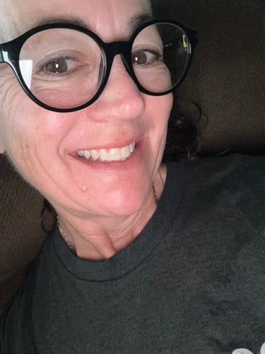 Customer photo review of The Microneedling Infusion System™