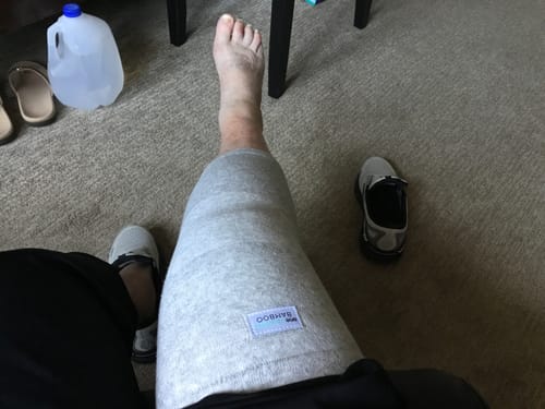 Customer photo review of Premium Bamboo Knee Sleeve (Single)