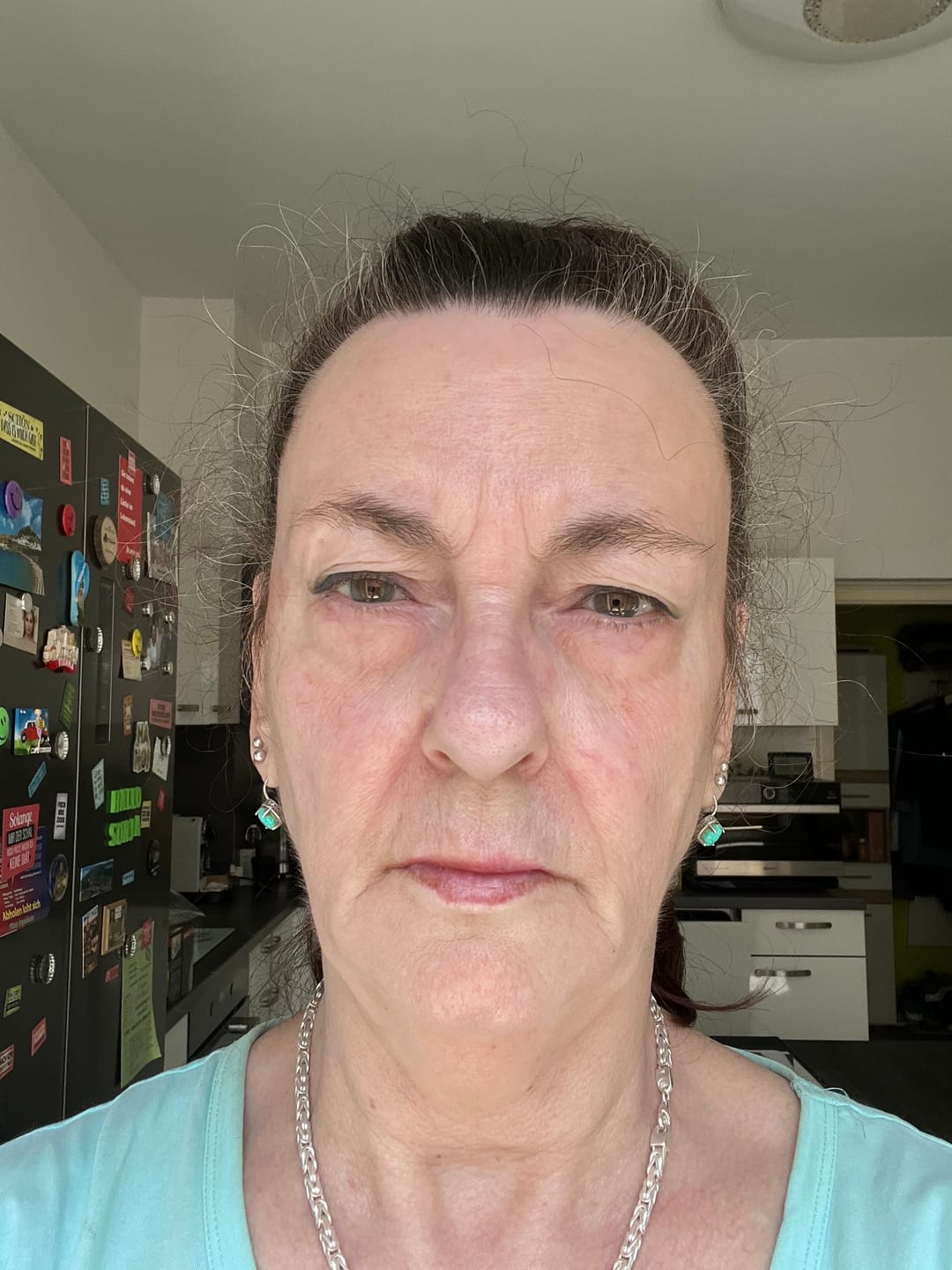 Customer photo review of Deep Collagen Cream
