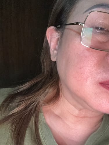 Customer photo review of Bad Skin™ Korean Collagen Bomb Hydrating Ampoule