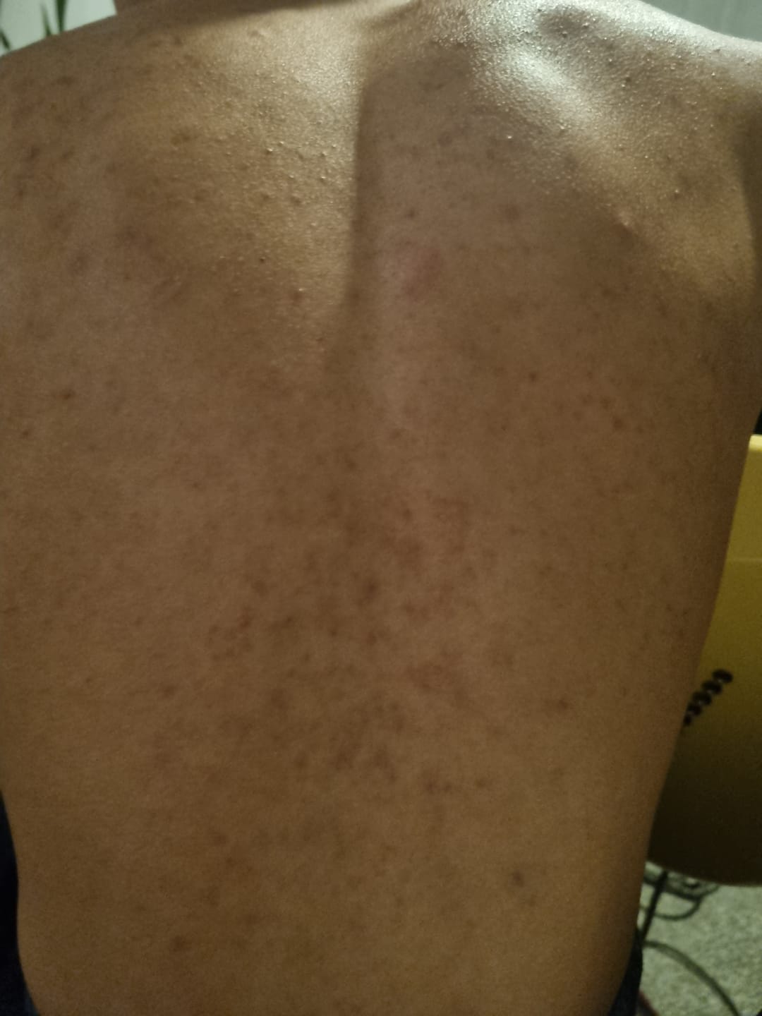 Customer photo review of Antiac Activ Liquid Spray