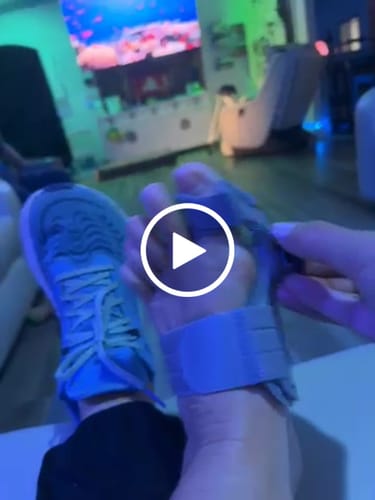 Customer video review of Treatmedy™ Bunion Fix - Natural At-Home Bunion Relief