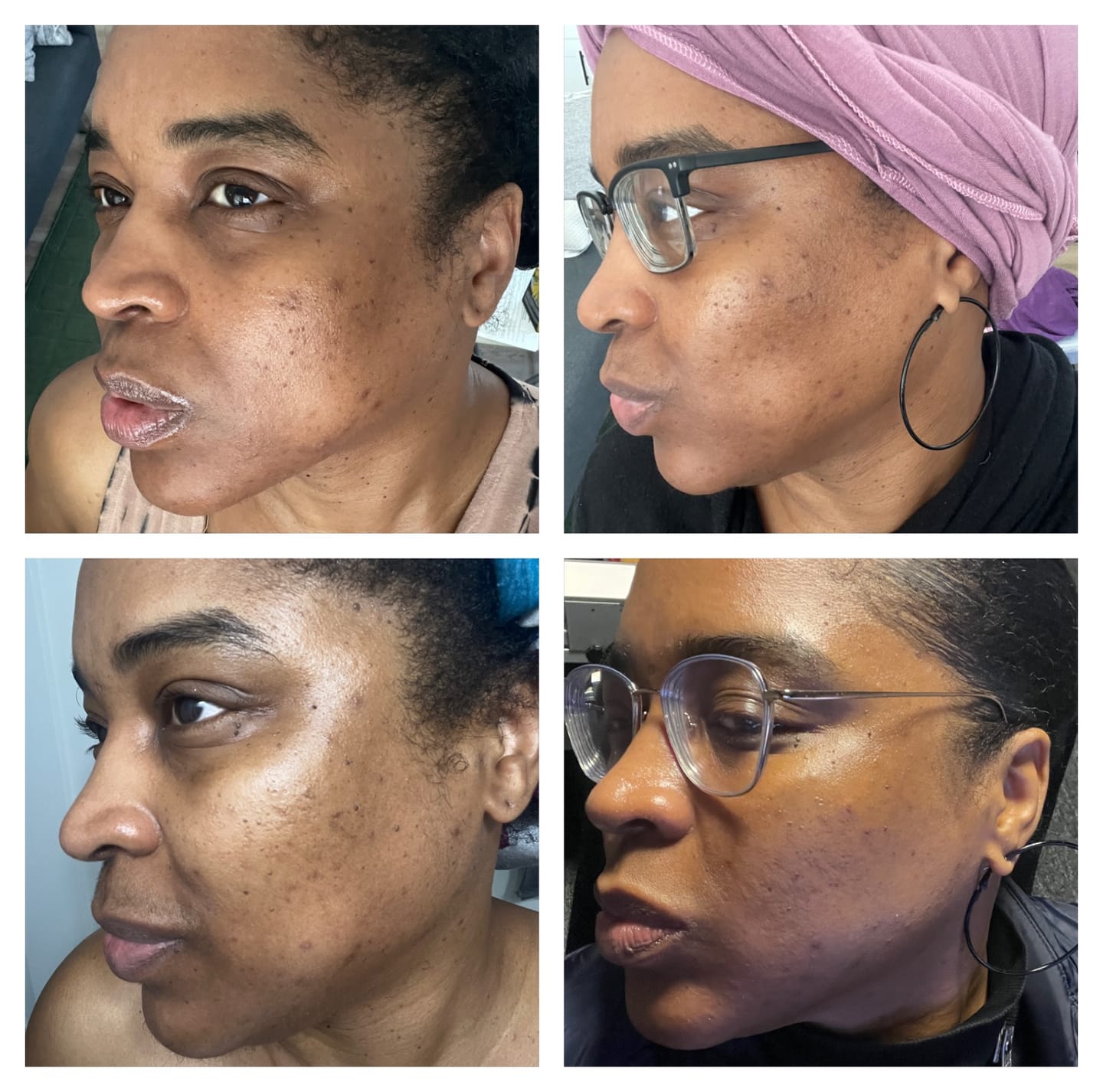 Customer photo review of DAILY C ANTIOXIDANT SERUM