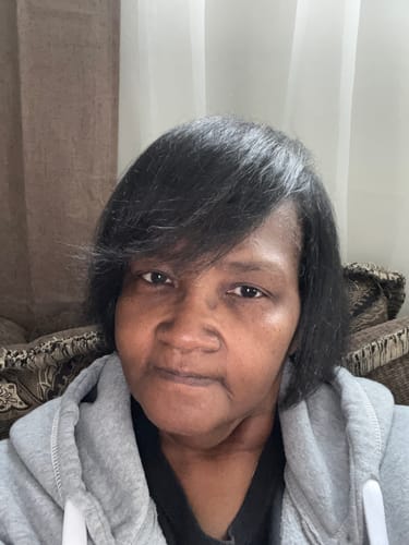 Customer photo review of JUMBO Scalp Stimulator