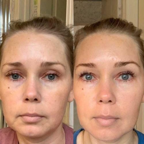 Customer photo review of Collagen Boosting Mask
