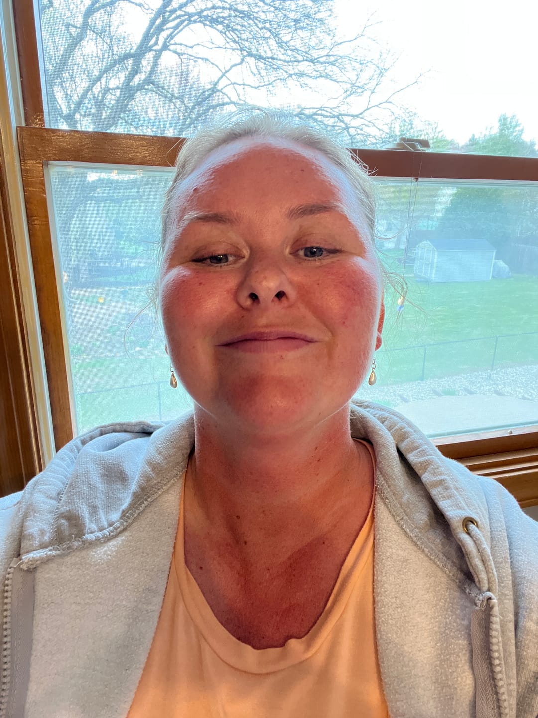 Customer photo review of Faux Pearl Drop Dangles Hypoallergenic Earrings for Sensitive Ears Made with Plastic Posts