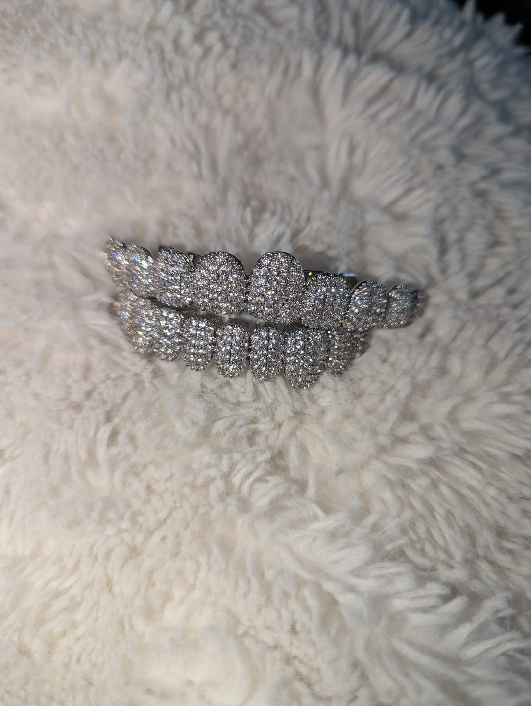 Customer photo review of 18k Gold Diamond Grillz