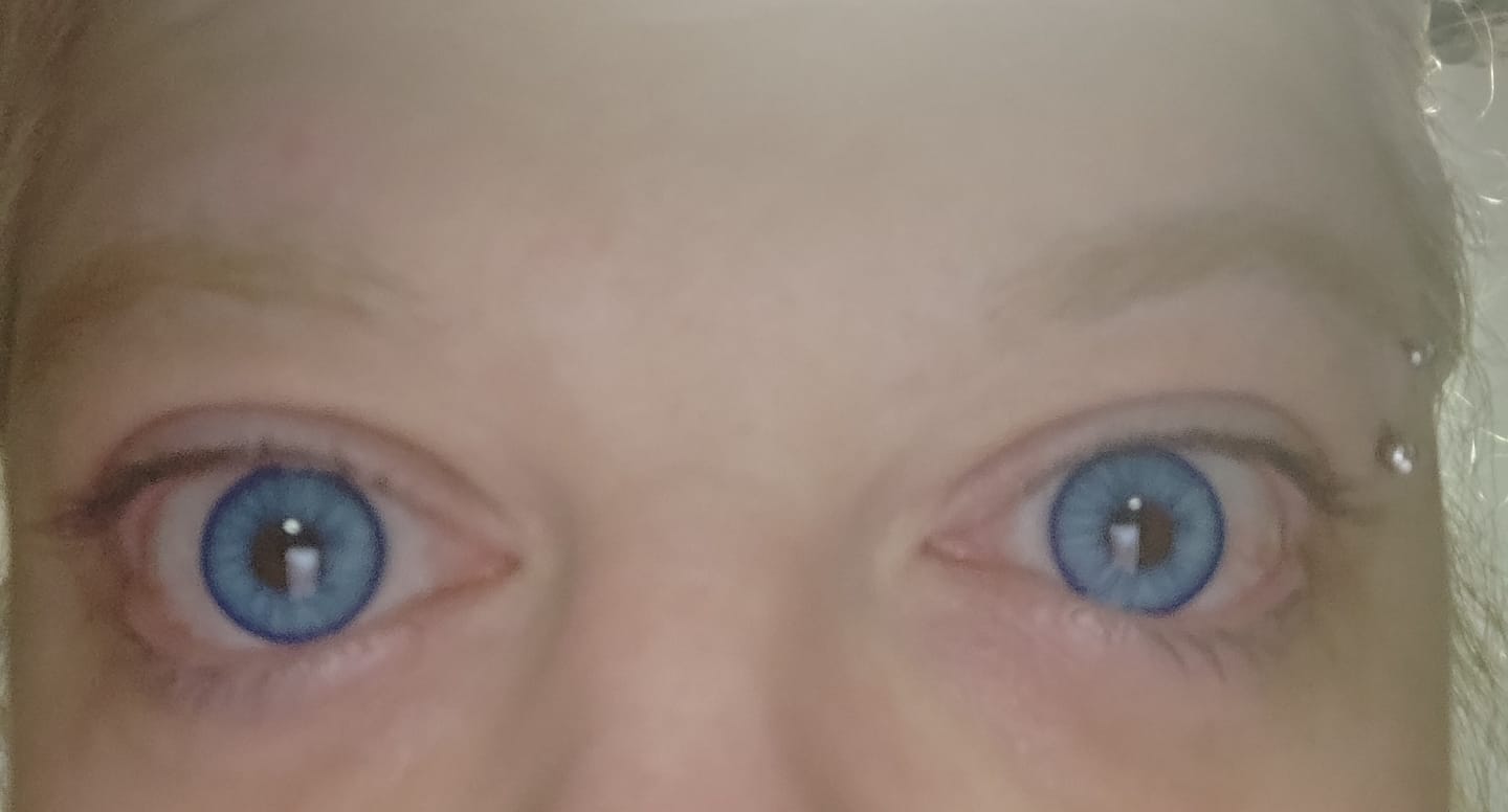 Customer photo review of Amaretto Blue Prescription Coloured Contact Lenses