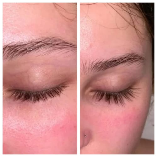 Customer photo review of Emily™ - Luxe Serum Bundle Set