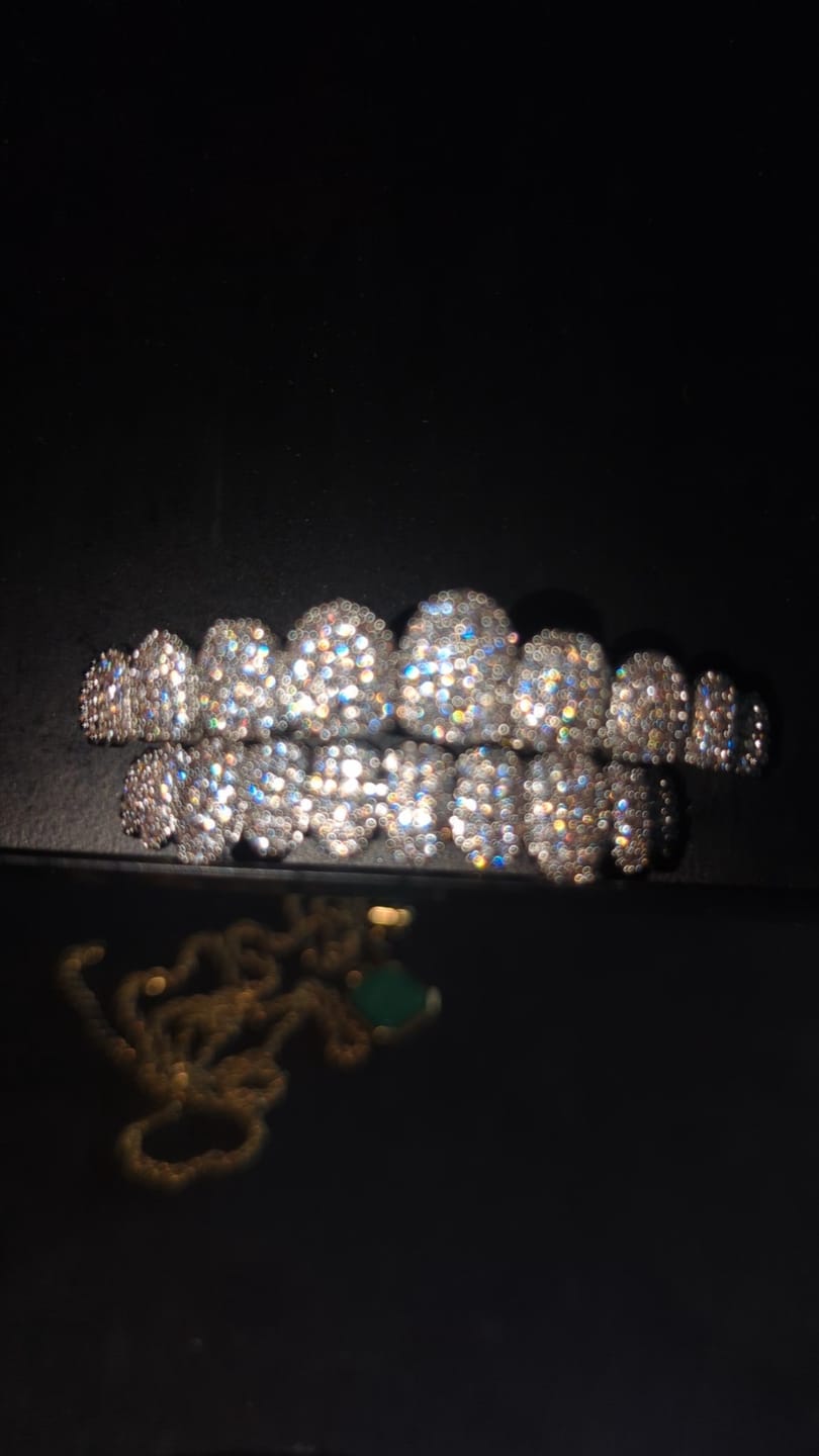 Customer photo review of 18k Gold Diamond Grillz