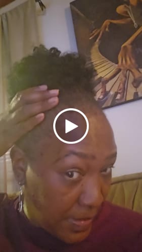 Customer video review of Rennora Hair Growth Serum