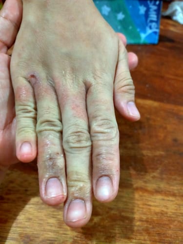 Customer photo review of Jolicare Cream