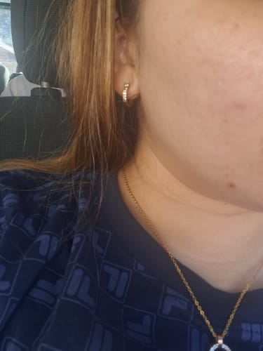 Customer photo review of The Super Glo Hydro Boost Jelly Moisturiser