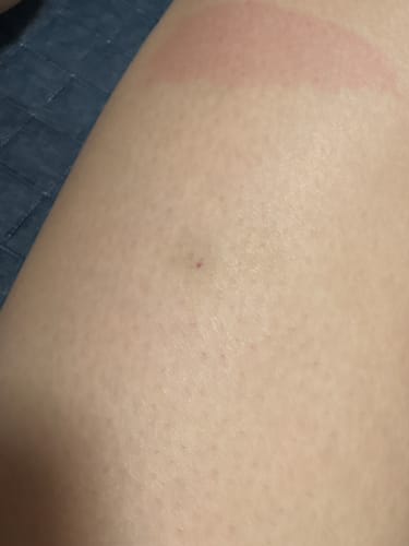 Customer photo review of 【半額】マンジャロ 2.5mg x 4/1ヶ月毎 GLP-1ダイエット注射