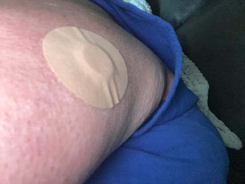 Customer photo review of Skin Grip MAX Freestyle Libre 3 Patches - 10 Pack