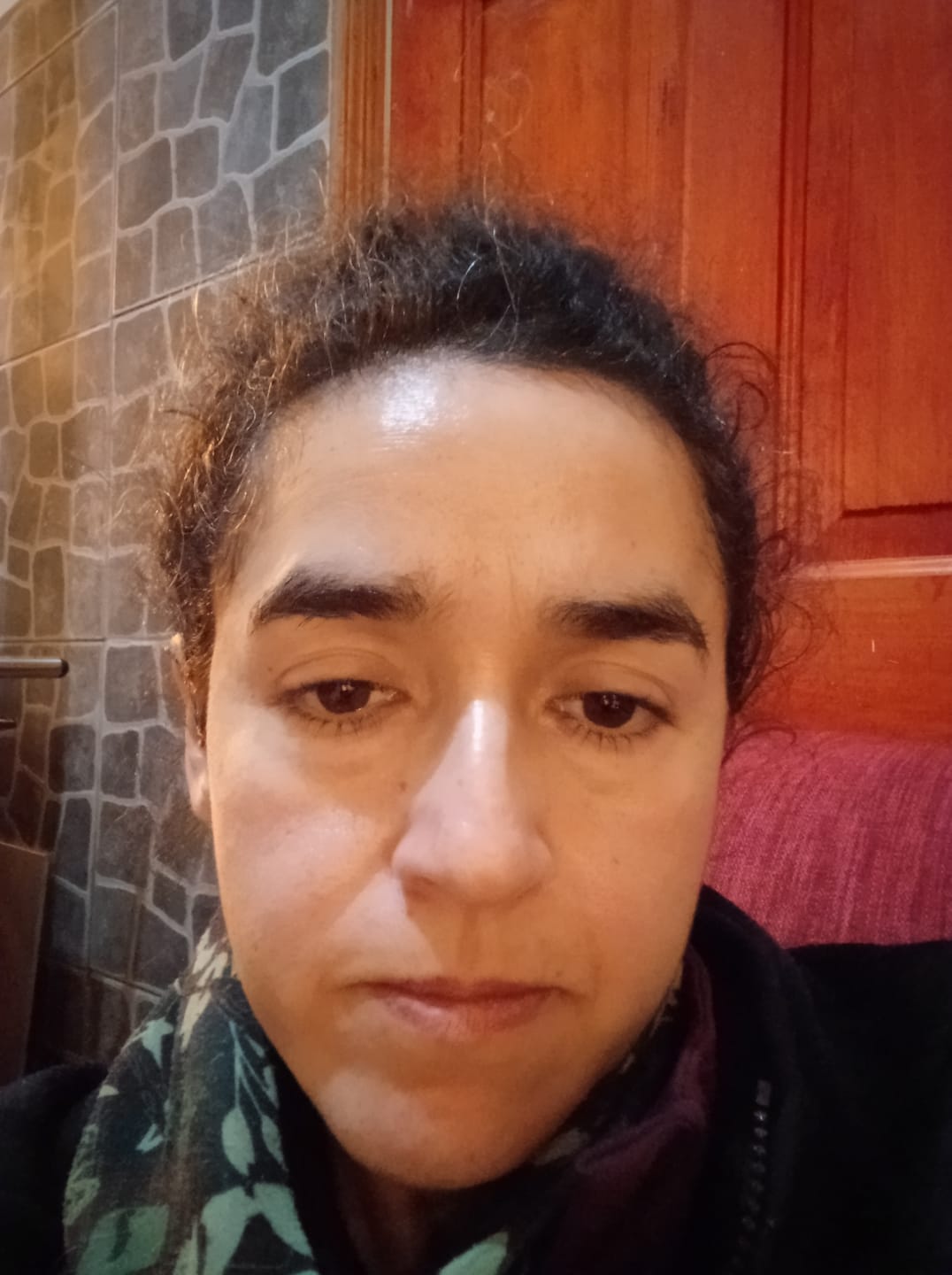 Customer photo review of Sérum Facial Antiedad Amplen Péptidos 30ml