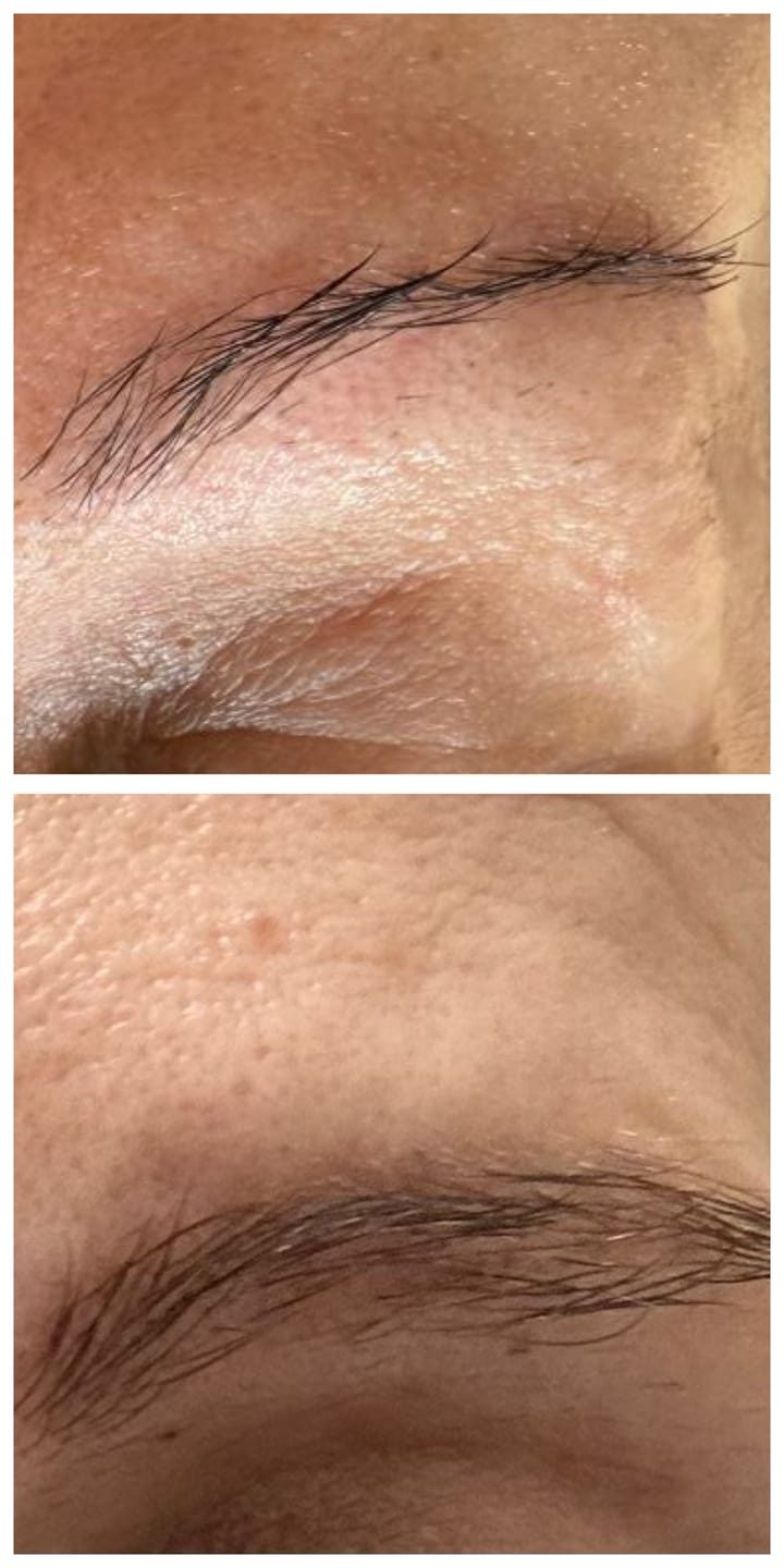 Customer photo review of BM Vita Brows - Augenbrauenserum 30 ml