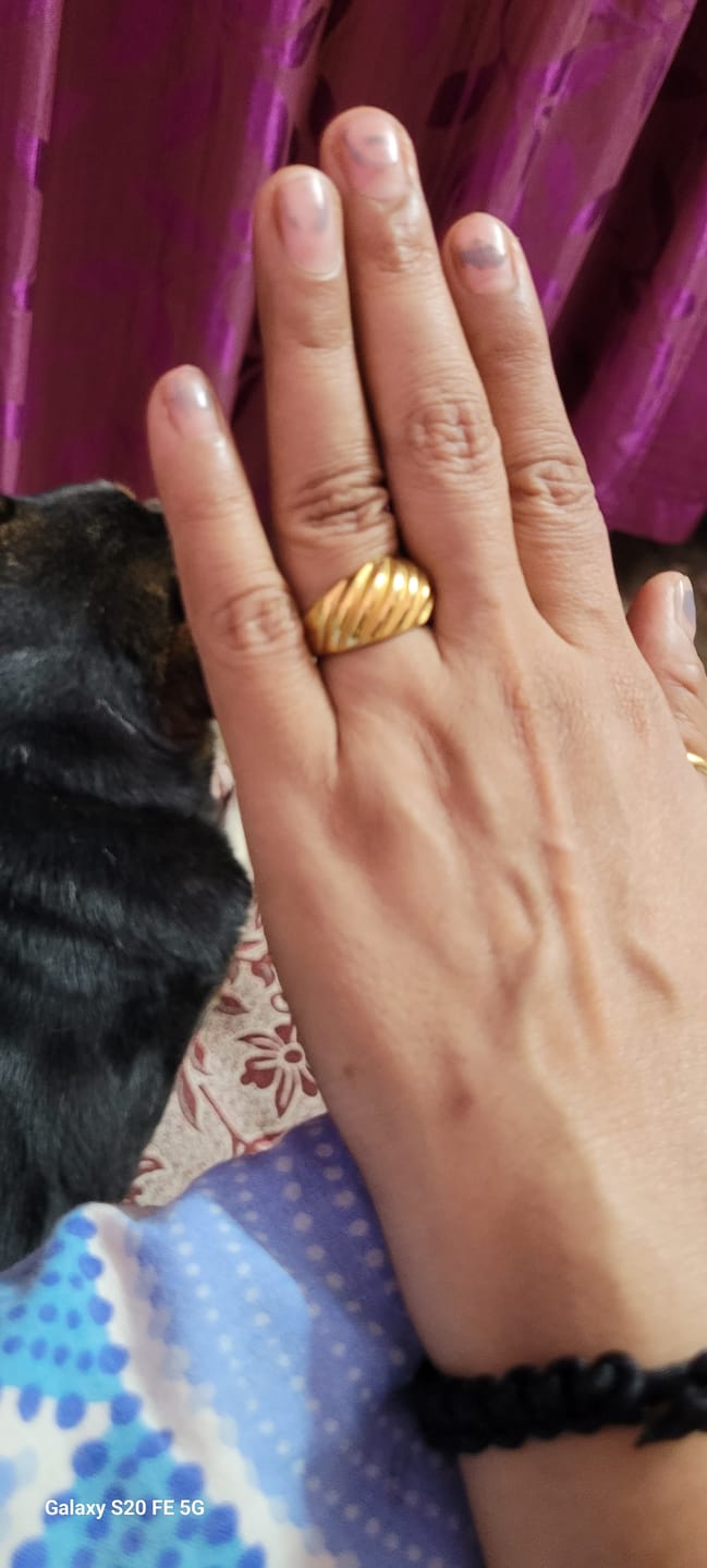 Customer photo review of Twisted Dome Ring