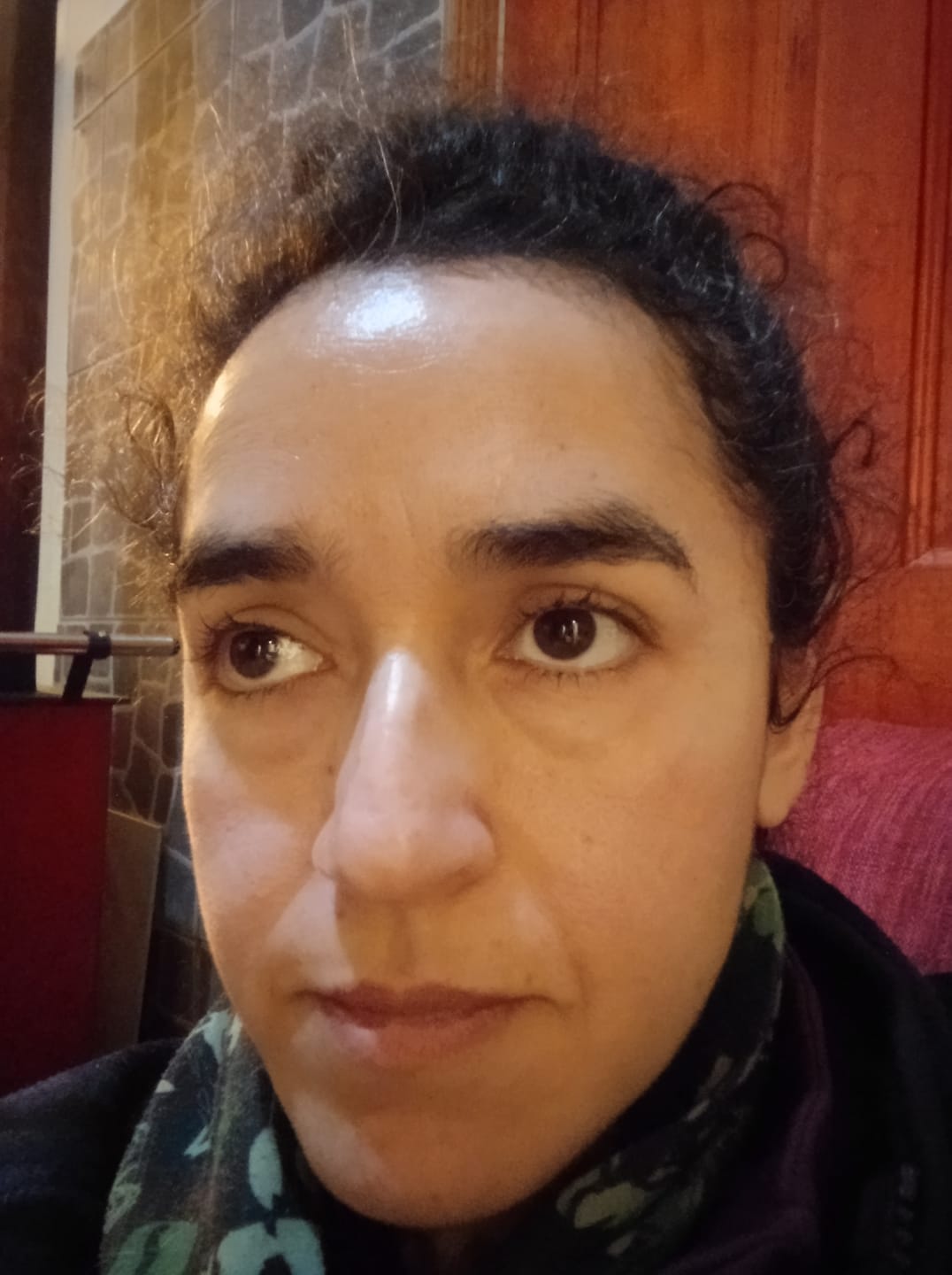 Customer photo review of Sérum Facial Colágeno Redensificador 30ml AMPLEN