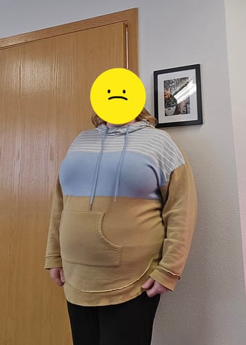 Customer photo review of Tirzepatide Weight Loss Program (Three Months)