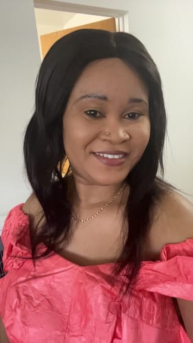 Customer photo review of Organic Exfoliating Cream with SPF (for darks spots and sunburns)