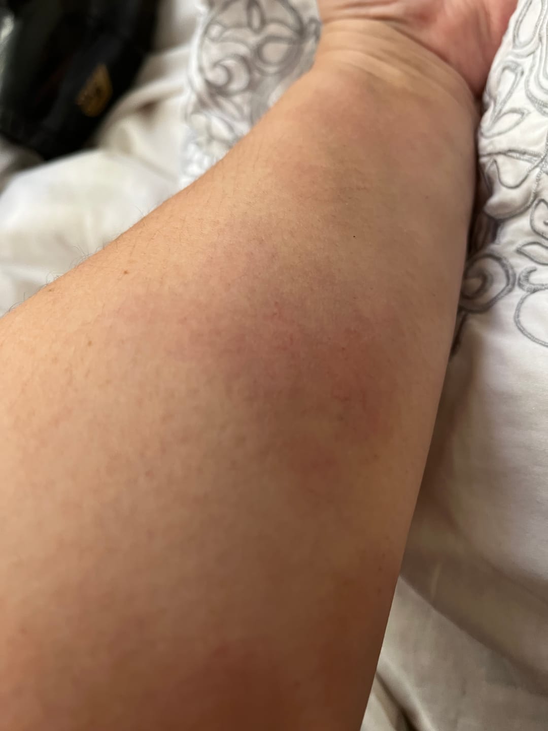 Customer photo review of Bright Skin Bish
