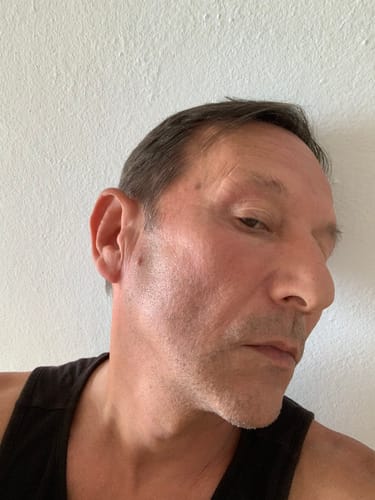 Customer photo review of Glov Micro Infusion System