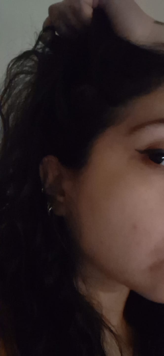 Customer photo review of Pack Anticaída de Cabello para 1 Mes