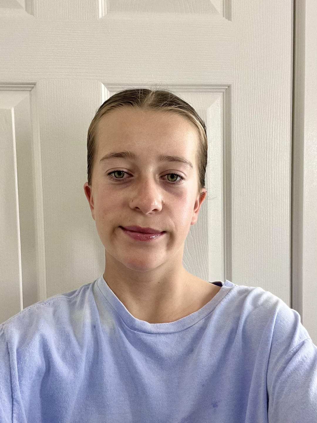 Customer photo review of Teen Glow Complete Skin Care Set with Cleanser, Toner and Moisturizer