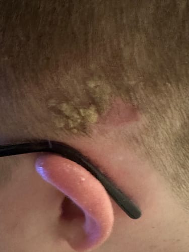 Customer photo review of Seb Natural Calming Serum