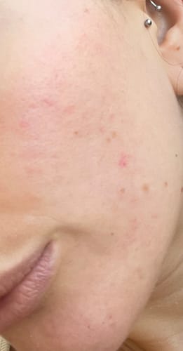 Customer photo review of 20-Day Inside & Out™