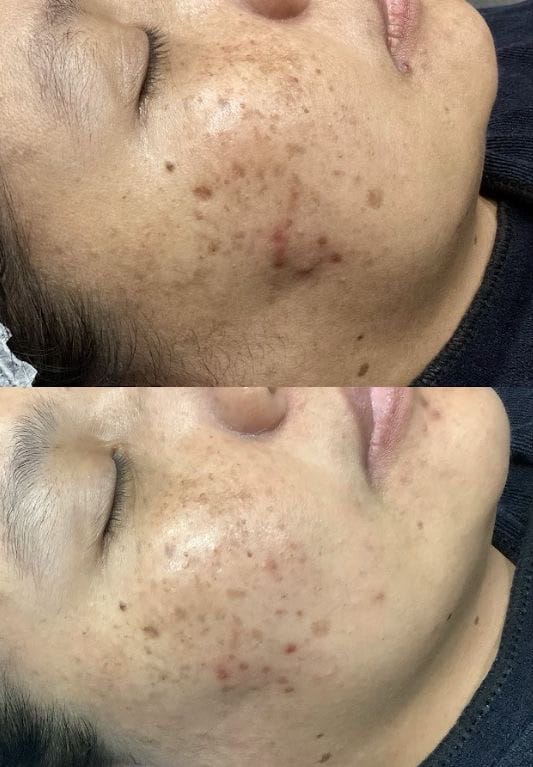Customer photo review of Gold Radiance Serum