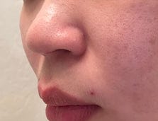 Customer photo review of Holy Basil Bubble Mask