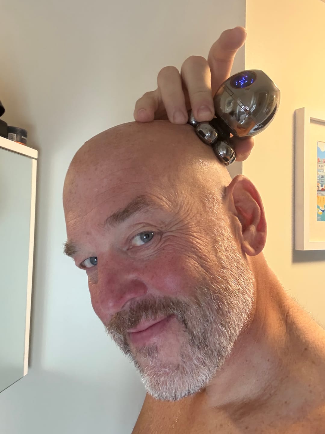Customer photo review of Trim Pod 2.0 Kit