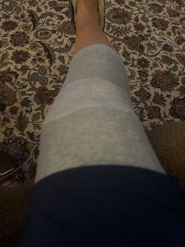 Customer photo review of Bamboo Compression Knee Sleeve for Night Pain