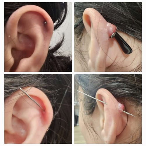 Customer photo review of Piercing Bump & Keloid Treatment Oil Wholesale (Custom)