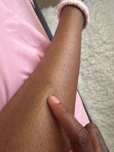 Customer photo review of Turmeric Brightening Soap (with Vitamin C, Alpha Arbutin, Oat)