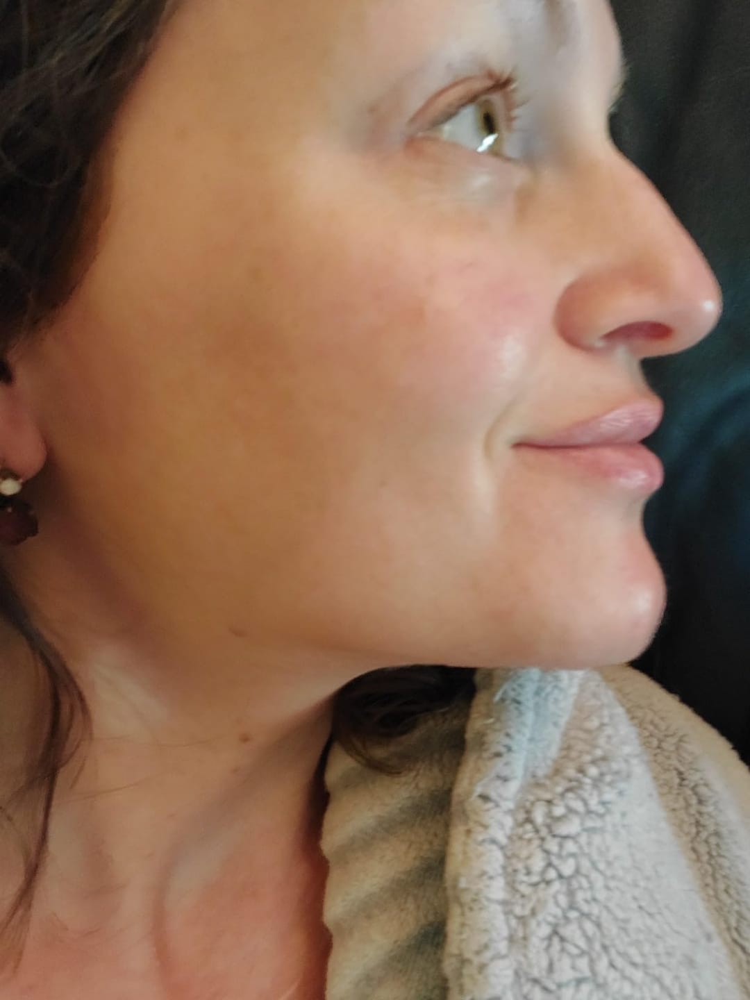 Customer photo review of Bellaskin Колагеново Желе