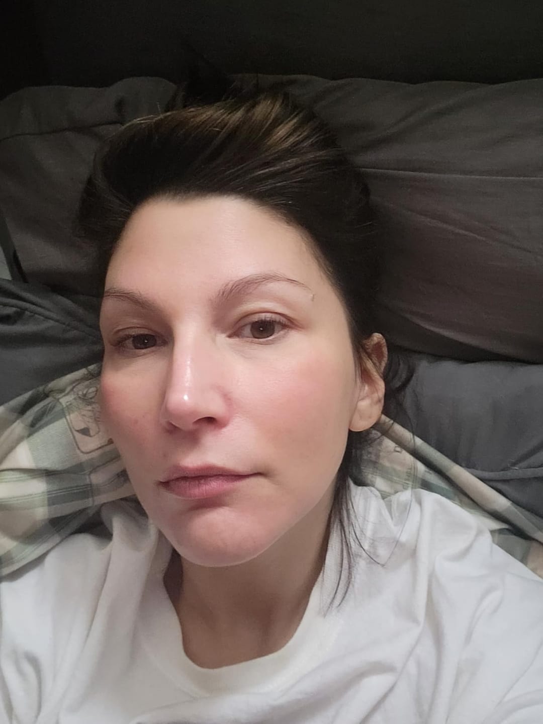 Customer photo review of Peel Shot Пилинг Ампула с Бял Ориз