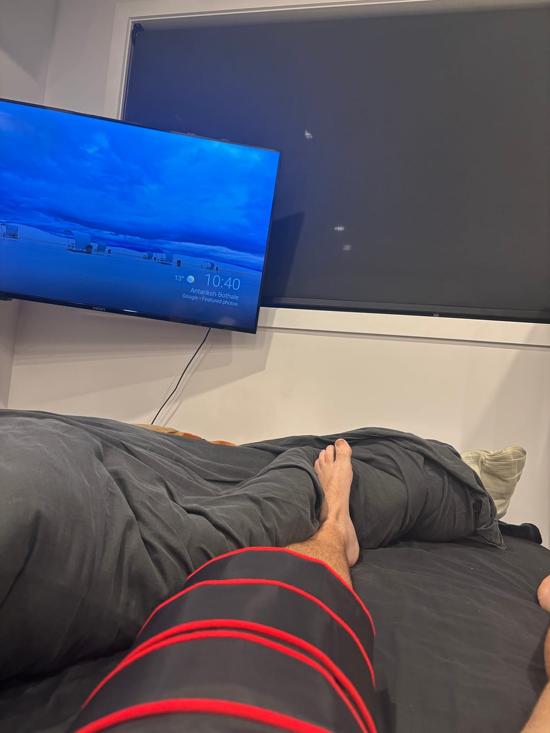 Customer photo review of Ice Compression Machine