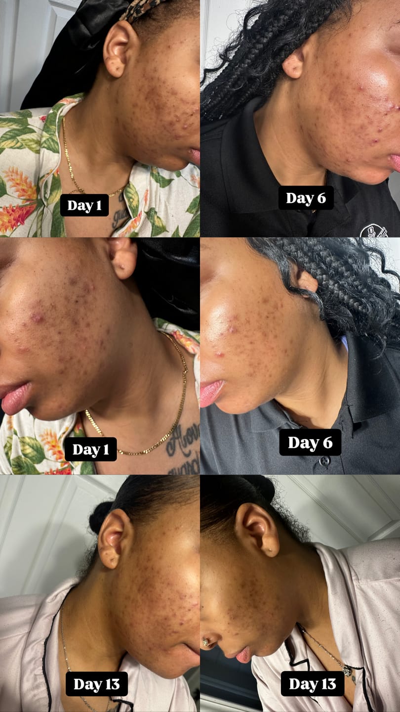Customer photo review of Jolie's Exfoliating Lip Brush