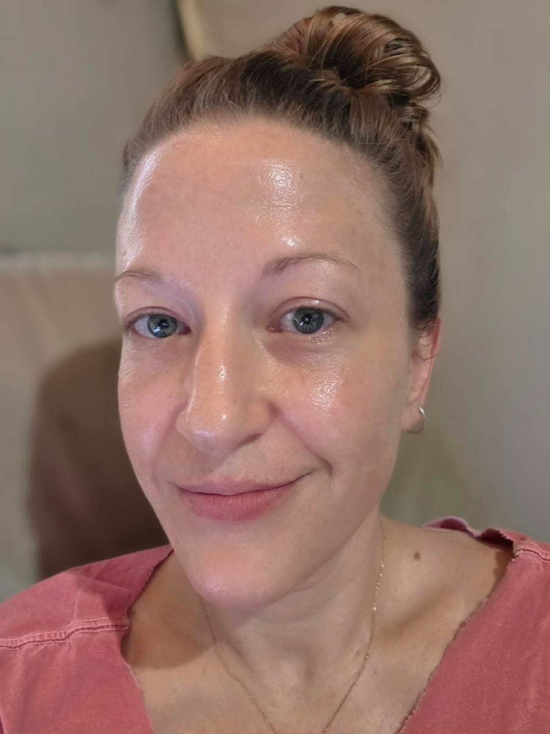 Customer photo review of Peel Shot Пилинг Ампула с Бял Ориз