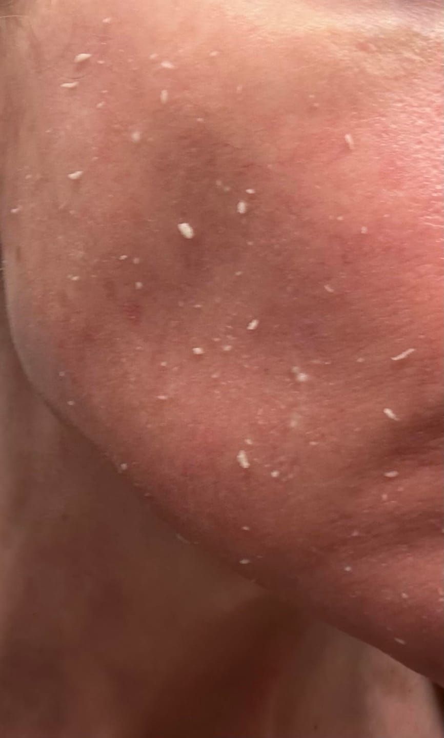 Customer photo review of Peel Shot Пилинг Ампула с Бял Ориз