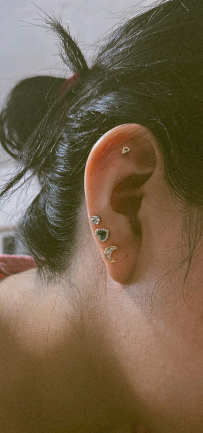 Customer photo review of Acero Quirúrgico Dorado Con Zirconias Primera Perforación