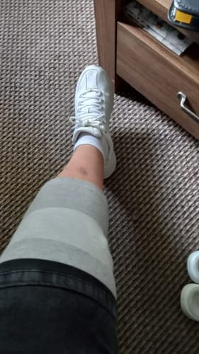 Customer photo review of Bamboo Compression Knee Sleeve for Night Pain